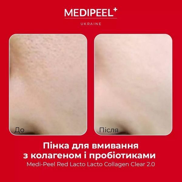 Пінка Medi-Peel Red Lacto Collagen Clear 2.0 для вмивання з колагеном 120 мл 8809409340098 фото